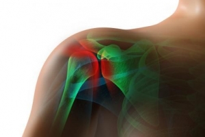 Hoe om Rotator Cuff-spiere te versterk